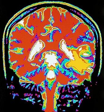 mri brain scan. Brain and Mind